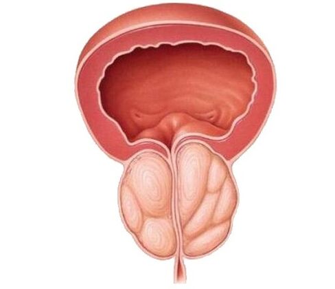 Aumento della prostata e trattamento con capsule Uosaf