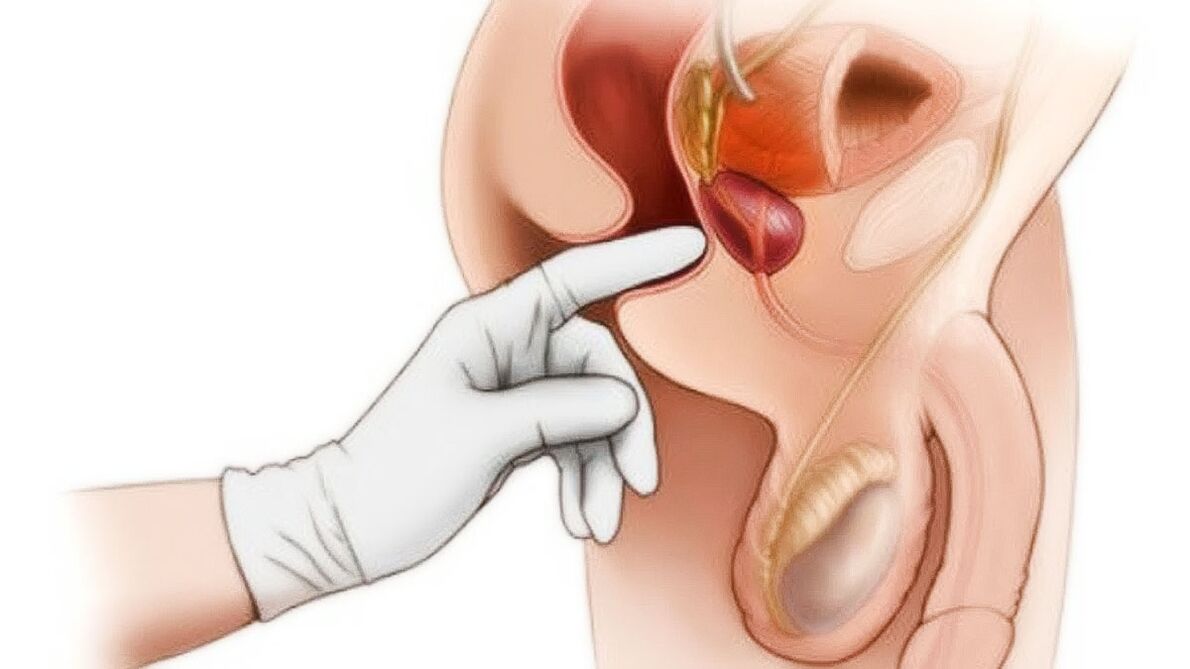 Massaggio alla prostata