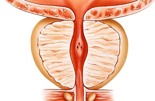 prostatite